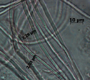 Faserhyphen, um die 2-3,5 µm, langgestreckt und sehr biegsam, Foto: Rüpke