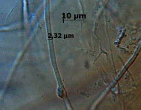 Grundhyphe 2,32 µm mit Schnalle. Foto: Rüpke