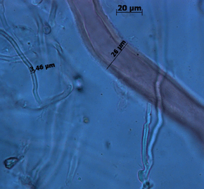 Gefäßhyphe 26 µm mit sehr dicken Gefäßwänden. Foto: Rüpke
