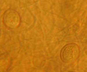 Ausgebreiteter Hauspoling, Donkioporia expansa: Arthrosporen im Substratmycel.