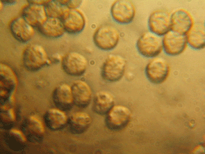 Schleimpilzsporen 8 µm