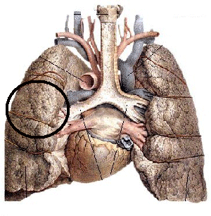 Zum Vergleich: das Relief einer Lunge.