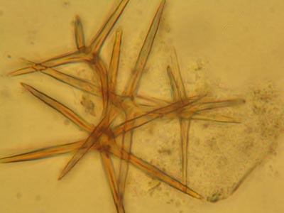 Sternseten des Sternsetenpilz, Asterostroma spp.